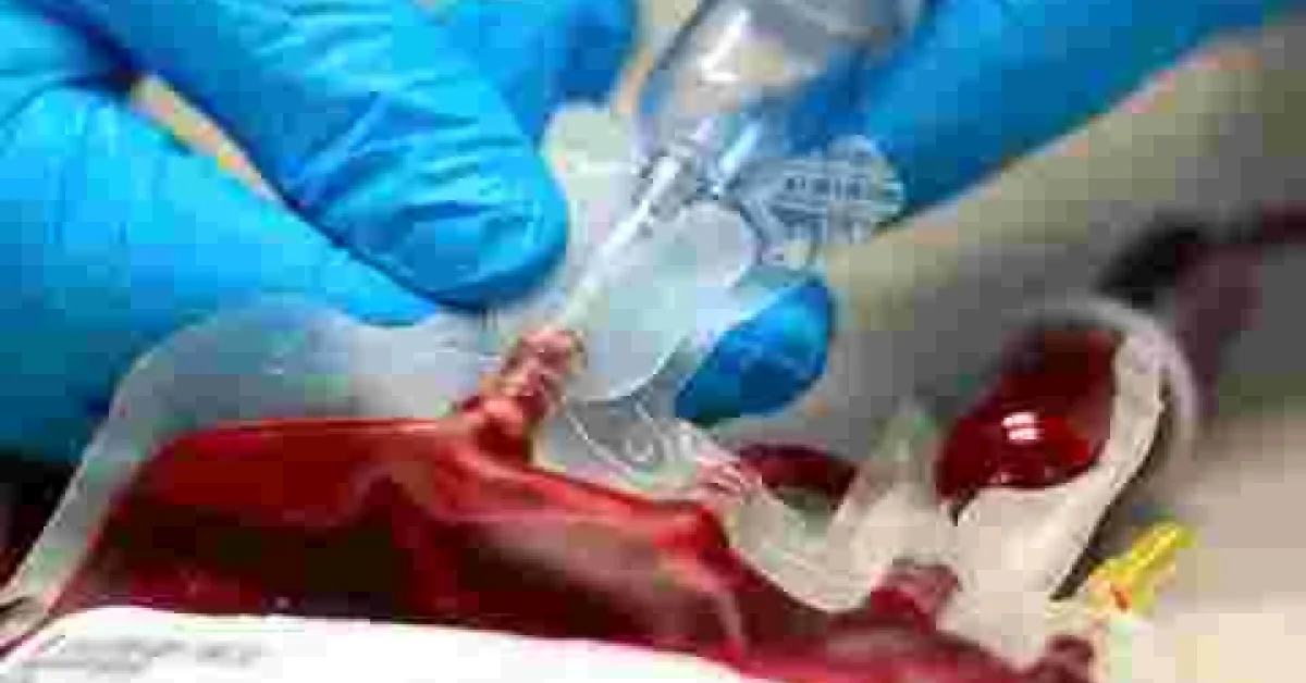 Kenyan Woman Attempts to Sell Her Blood to Raise School Fees for Daughter Who Scored 380 Marks