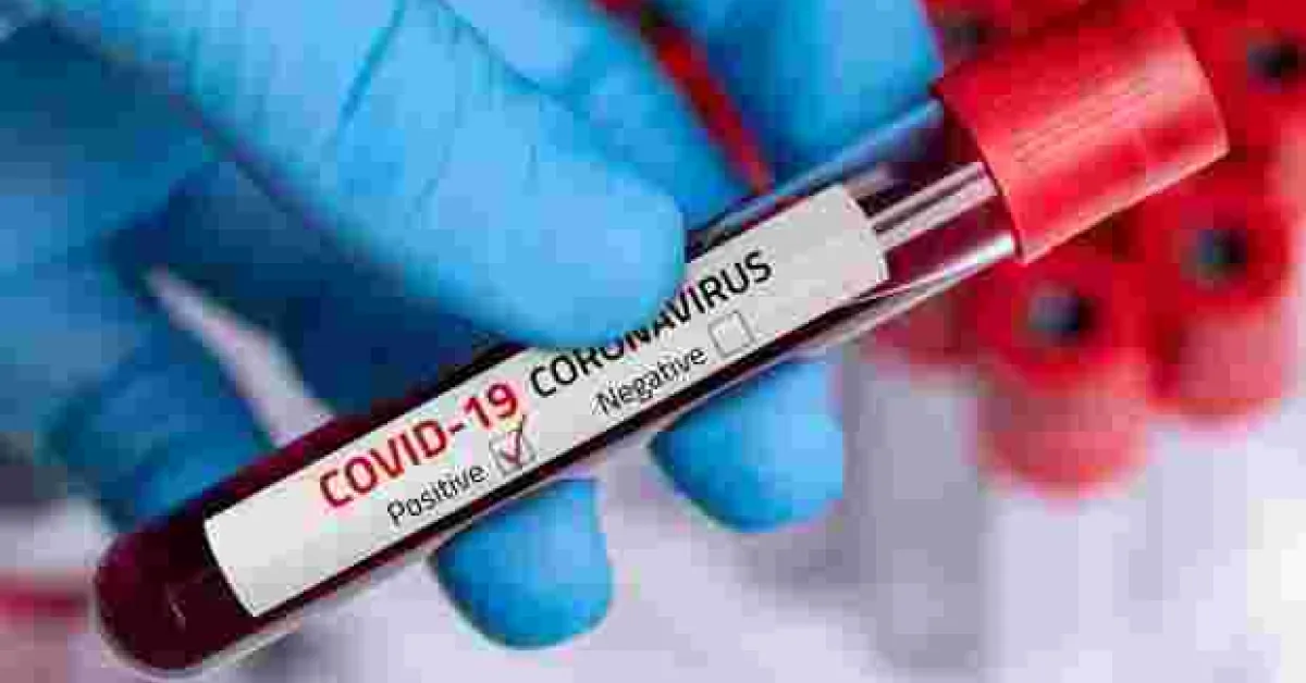16 People from Nairobi, Mombasa Test Positive for Covid-19, Tally Rises to 336