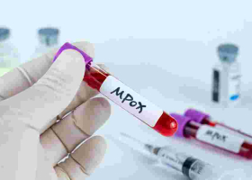 Kenya Intensifies Mpox Surveillance Amid Rising Cases