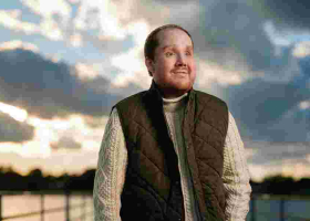 How 80 Surgeons Rebuilt a Human Face in 50 Hours After Suicide Attempt