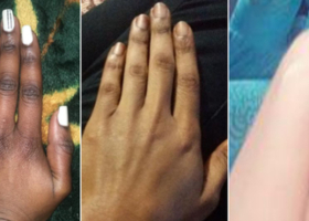 Kenya Battles Skin Bleaching Trend Despite Ban on 400 Dangerous Cosmetics