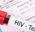 Nairobi HIV Rate Falls to 3.7%, Contrary to Earlier Reports