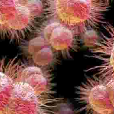 Man Contracts 'World Worst' Super-Gonorrhea 