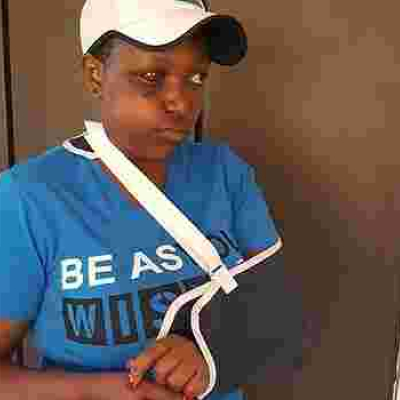 Female Nyeri MCA Sustains Serious Injuries after Male Colleague Hits Her with a Beer Bottle During Bench-Marking Tour in Tanzania