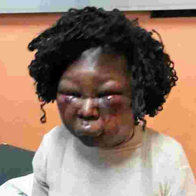 Kenyan Man Who Battered Expectant Wife Almost to Death Arrested