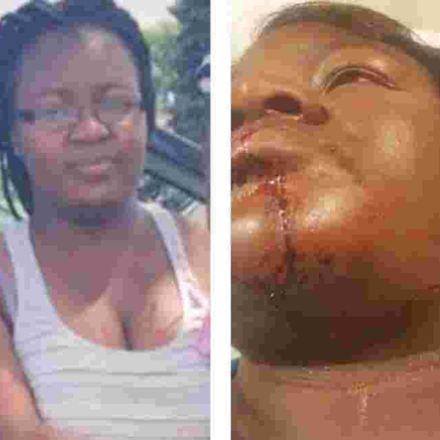 Kenyan Woman in Minnesota Nursing Serious Injuries after Attack by Husband at a Petrol Station