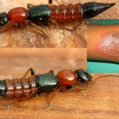 Kenyans Decry the Return of the Dreaded ‘Nairobi Fly’