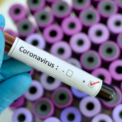 Nigeria Confirms Coronavirus Case, the First in Sub-Saharan Africa
