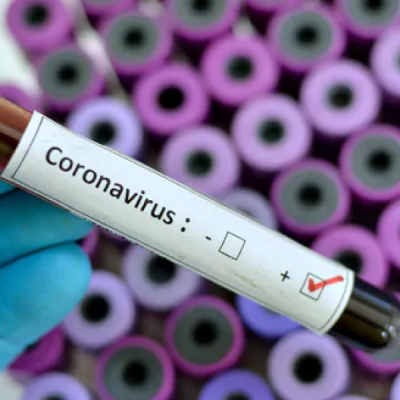 Cameroon Records its First Coronavirus Case 
