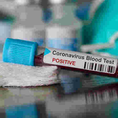 Ugandan Man, Daughter Arrested with Alleged Coronavirus ‘Vaccine’