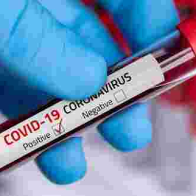 Covid-19 May be Transmitted Through Sex, Study Shows 