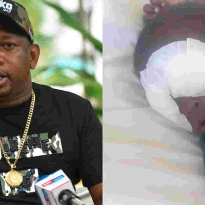 Sonko Offers to Fly Baby Sagini to South China for Eye Implants