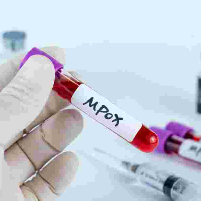 Kenya Intensifies Mpox Surveillance Amid Rising Cases