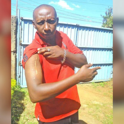 Kiambu Man Shot 13 Times Defies the Odds, Rebuilds Life After Deadly Attack
