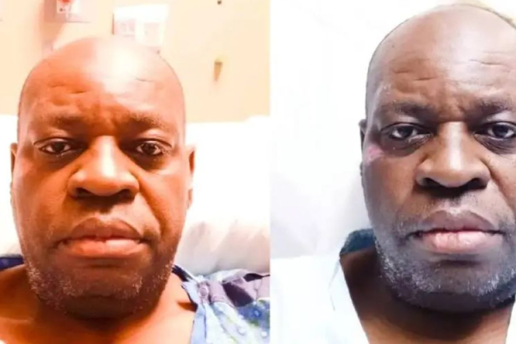 Kenyan Man in US Appeals for Support as Cancer Reaches Stage Four