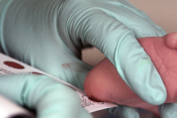The First Cry Isn't Enough: Why Every Baby Should Be Screened at Birth