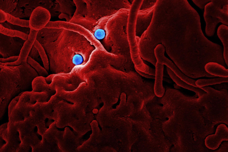 Ebola Outbreak Worsens as Scientists Rush to Test New Treatments
